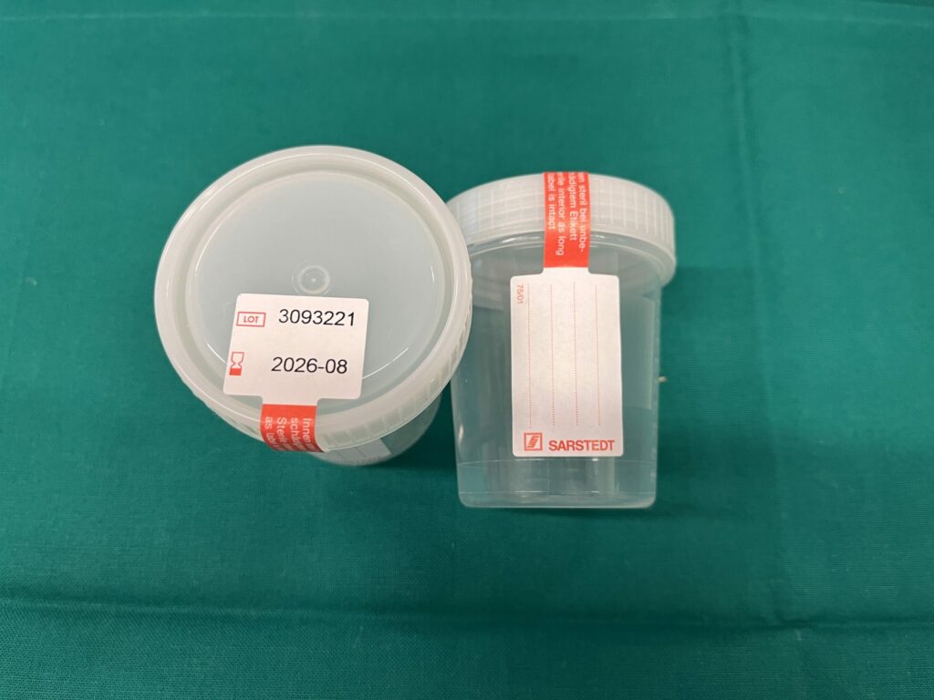 Blasenspülbecher IVF steril 100ml